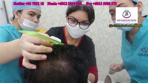 GET YOUR HAIR TRANSPLANT DONE AT IPLUS HAIR REGROWTH EXPERT YouTube