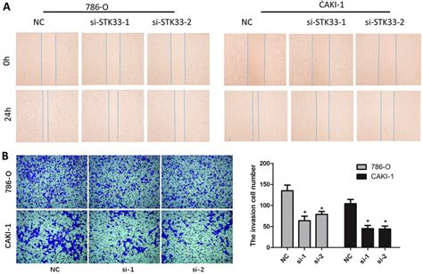 Stk33 Knockdown Reduced Cell Migration In 786 O And Caki 1 Cells A Download Scientific