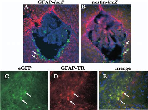 Cellular Tropism Of CMV Brain Infection In Vivo Coronal Murine Brain