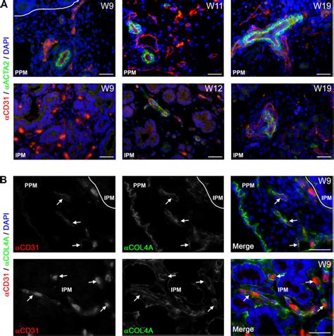 Blood vessels and their association with smooth muscle cells and ... 