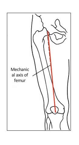 Biomechanics Exam Flashcards Quizlet