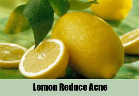 12 Natural Cure For Acne Simple Tips To Cure Acne Naturally Search