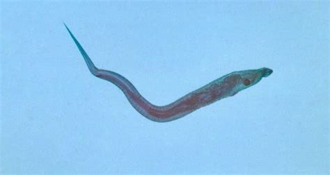 Pinworm - What Is Pinworm Infection, Its Causes, & Signs and Symptoms