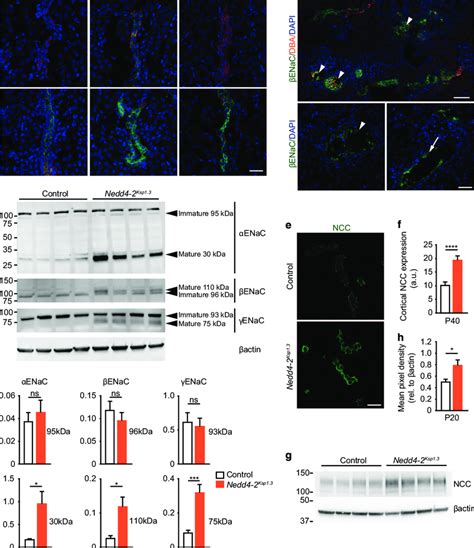 Increased Expression Of Active ENaC And NCC In P40 Nedd4 2 Ksp1 3 Mice