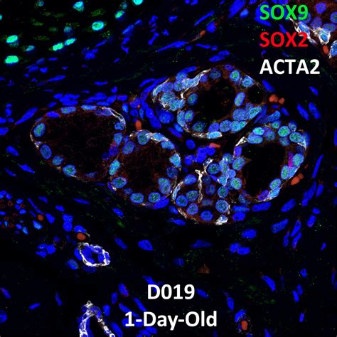 1 Day Old Human Lung Confocal Imaging SOX9 SOX2 And ACTA2