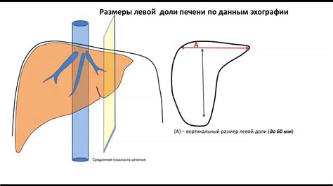 Лекция: Размеры печени (с демонстрацией на пациенте) - YouTube
