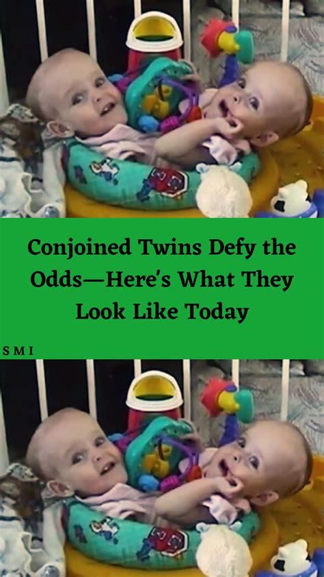 Clever Comebacks Hgtv Shows Conjoined Twins Nicole Curtis Panda Funny Identical Twins Two