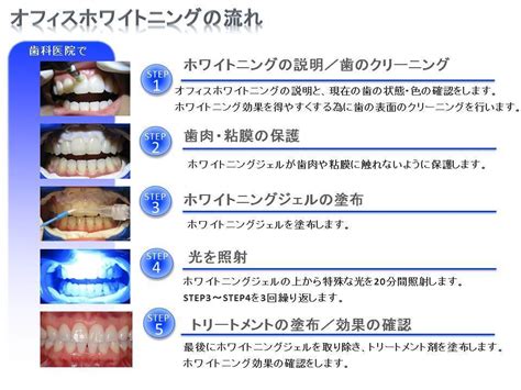 ホワイトニング ノーブルデンタルクリニック仙台仙台駅東口