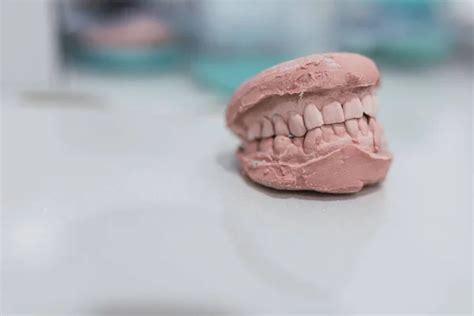 Dental Casting Gypsum Model Plaster Cast Stomatologic Human Jaws