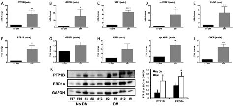 Selective Deficiency In Endothelial Ptp1b Protects From Diabetes And Endoplasmic Reticulum