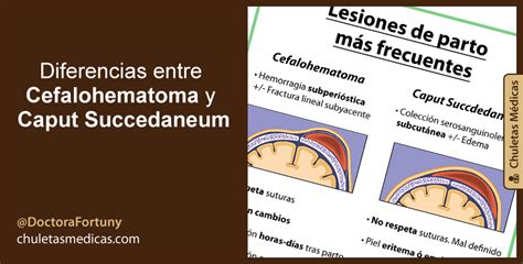 Diferencias Entre Cefalohematoma Y Caput Succedaneum Chuletas M Dicas