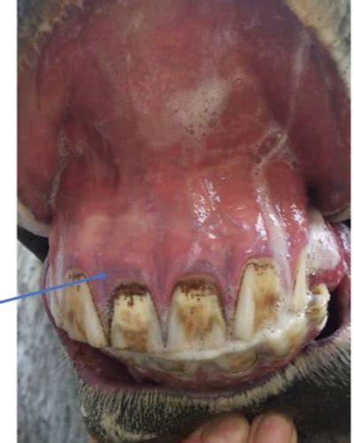 Alimentary Tract Pathology 2003 Flashcards Quizlet