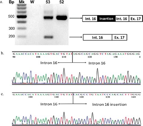 Pcr And Sequencing Of Ace Gene A Gel Electrophoresis Of Pcr