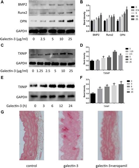 Galectin 3 Induced Aorta And VSMCs Calcification Cells Were Treated