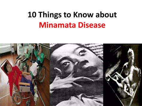 Minamata Diseasepptx Free Download