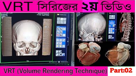 Video No 013 Learning Volume Rendering Technique VRT 2nd Part CT