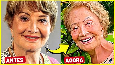 ATORES E ATRIZES DE BREGA E CHIQUE ANTES E DEPOIS VEJA COMO ESTÃO