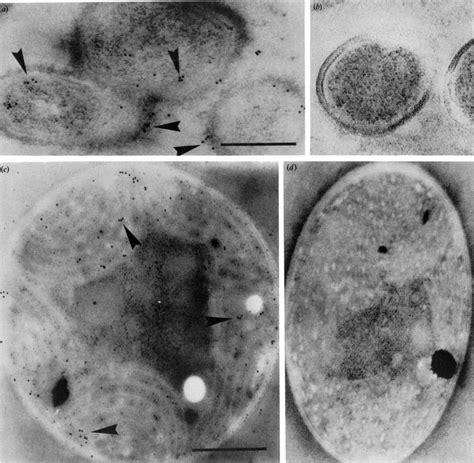 Immunocytochemical Localization Of Phytoene Desaturase In Rhodobacter