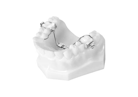 Orthodontic Appliances Universal Orthodontic Lab