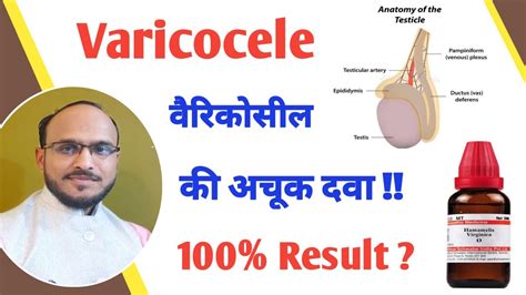 Varicocele Causes Symptoms And Treatment In Homeopathy By Dr Nikhil