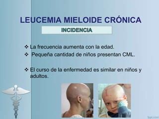 Leucemia Mieloide Cr Nica Huamanchumo Sandoval Samaria Ppt