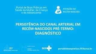 Persistência do Canal Arterial PCA em recém nascidos pré termo