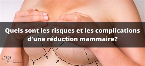 Risques Et Complications De La R Duction Mammaire