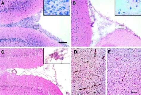 Mild Hypothermia Inhibits Inflammation After Experimental Stroke And