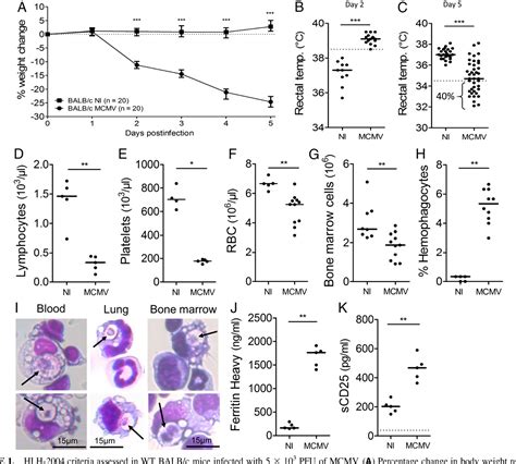 Figure 1 From Mouse Cytomegalovirus Infection In BALB C Mice Resembles