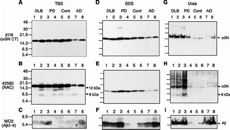 Western Blot Analysis Of ␣ Sn Expression In Human Brain Fractions