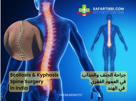 Scoliosis & Kyphosis Surgery in India: Best Hospitals - Safartibbi