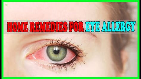 How To Relieve Itchy Allergy Eyes Instantly Home Remedies For Eye Allergy Youtube