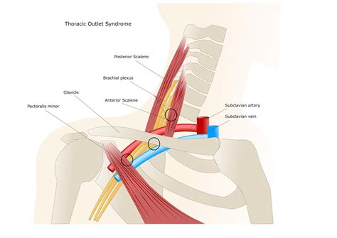 A Pain in the Neck! - Central Lakes Physio & Pilates