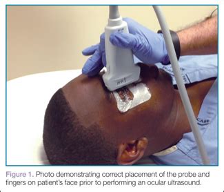 Emergency Ultrasound Bedside Ultrasound For Ocular Emergencies MDedge