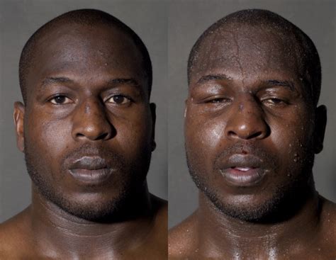 Photos Boxers Faces Before And After They Step Into The Ring Page 2