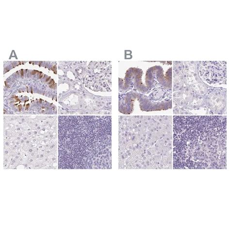 Anti Capsl Antibody Produced In Rabbit