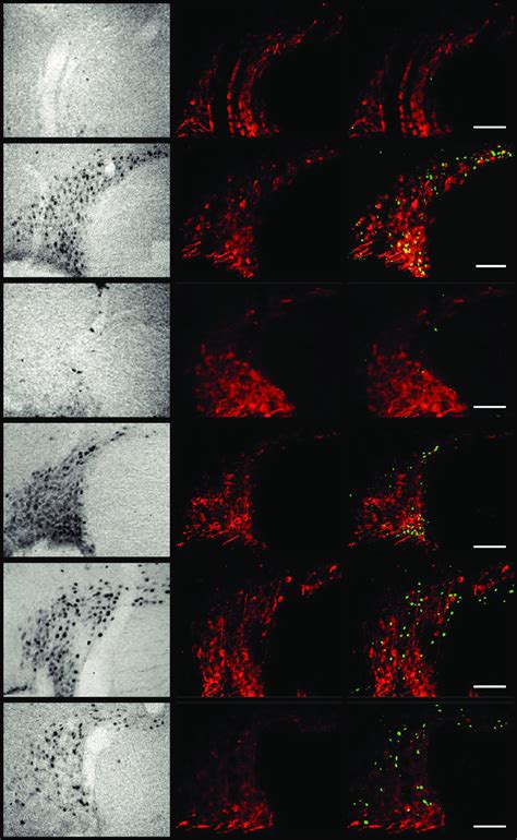 Representative Photomicrographs Depicting C Fos Staining Avp Staining