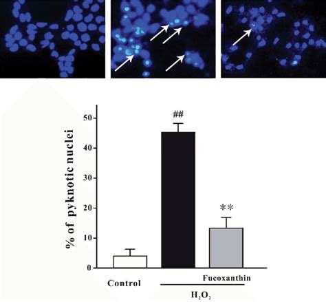 Fucoxanthin Significantly Protects Against H O Induced Apoptosis In