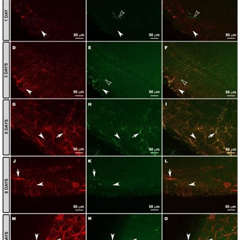 Retinal Whole Mount Double Immunostaining For Gfap Red And Mhc Ii