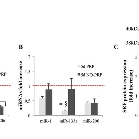 Real Time PCR Analysis Of MiR 1 MiR 133a And MiR 206 Expression Using