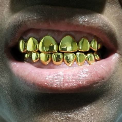 22k Gold Permanent Crowns