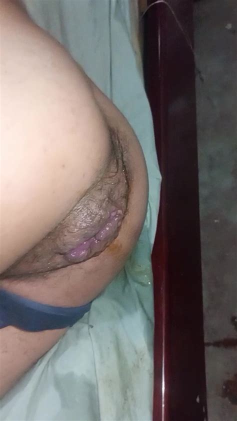Anal Dap Dp Fisting Solo Puke Vomit Farting Fisting Thisvid
