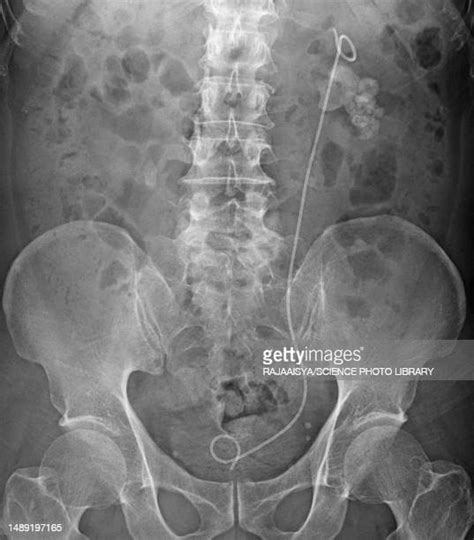 Excretory Organs Photos And Premium High Res Pictures Getty Images