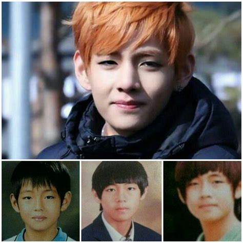 Bts Plastic Surgery Before And After Bts Have Plastic Surgery