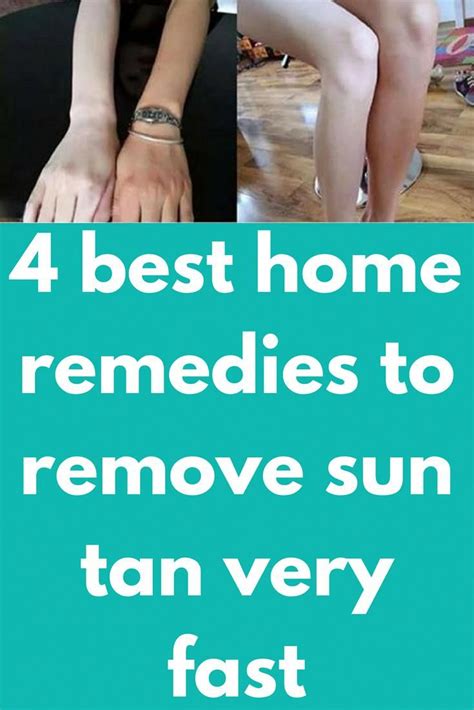 4 Best Home Remedies To Remove Sun Tan Very Fast There Are Many Natural