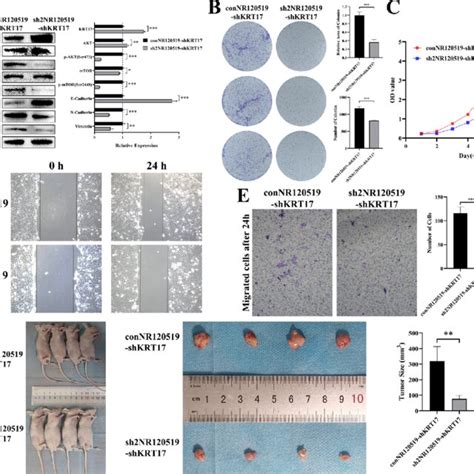 Knockdown Of Nr In Detroit Cell Line Inhibits Akt Mtor Pathway