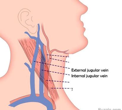 Sectional Anatomy Ch Dms Flashcards Quizlet