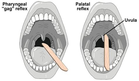 Vagal Maneuvers Simplified — NUEM Blog