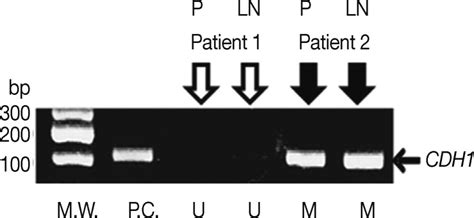 Representative Methylation Specific Polymerase Chain Reaction Results Download Scientific