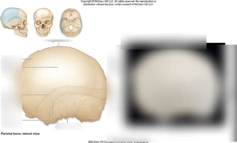 lateral view of the parietal bone Diagram | Quizlet